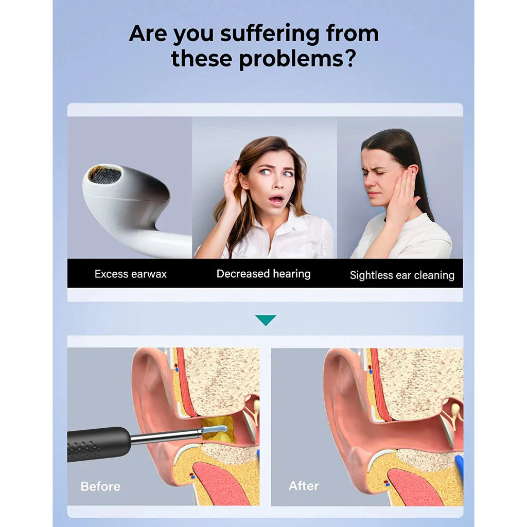 Smart Ear Care Camera For Home Ear Health Inspection And Hygiene