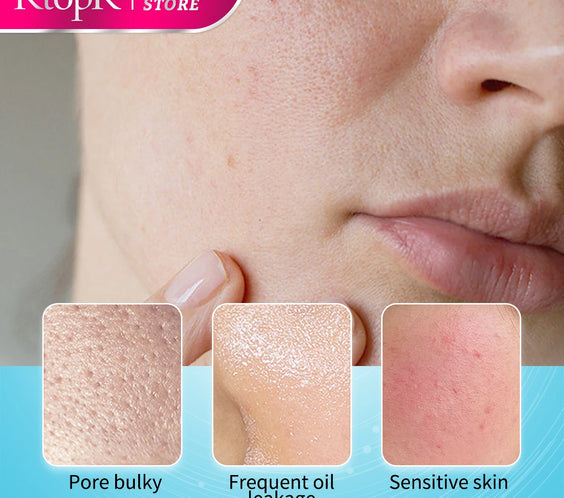 Pore Shrink Essence Serum