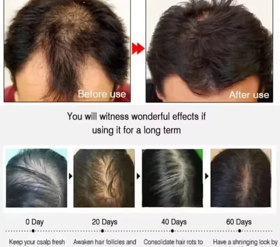 Fast Hair Regrowth Cream