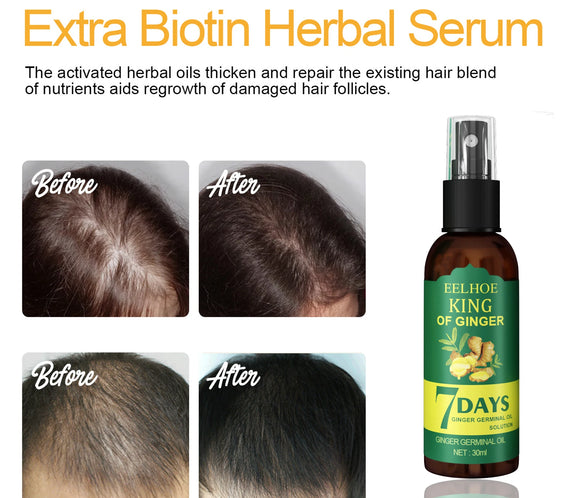 Ginger Scalp Serum Spray 30ml