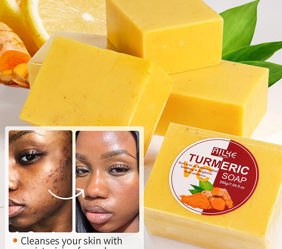 AILKE Turmeric Acne Soap 200g handmade yellow bar labeled turmeric hyaluronic acid glycerin kojic acid