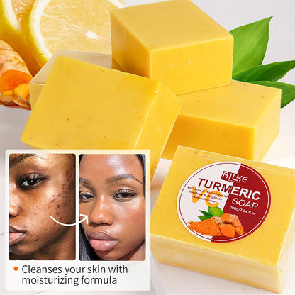 AILKE Turmeric Acne Soap 200g handmade yellow bar labeled turmeric hyaluronic acid glycerin kojic acid