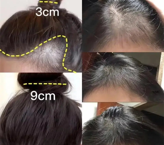Fast Hair Regrowth Cream