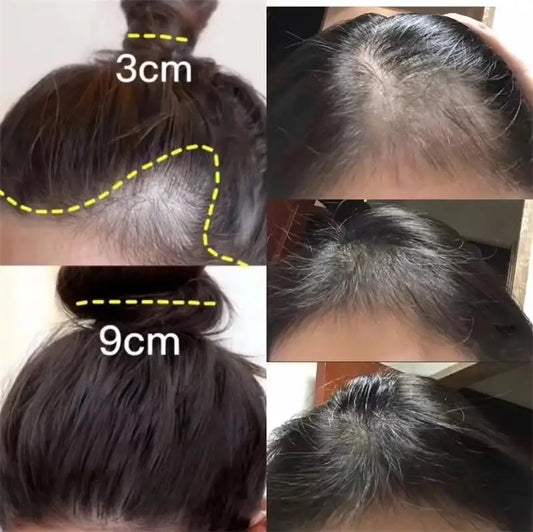 Fast Hair Regrowth Cream