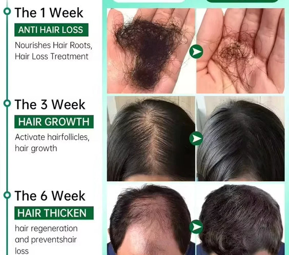 Ginger Scalp Growth Serum