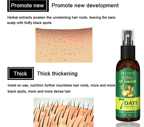 Ginger Scalp Serum Spray 30ml