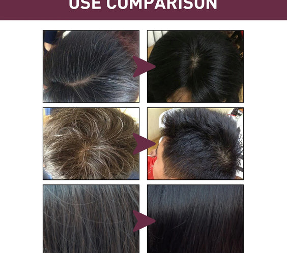 Polygonum Dandruff Shampoo 80g