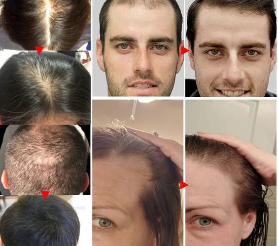 Ginger Scalp Growth Serum