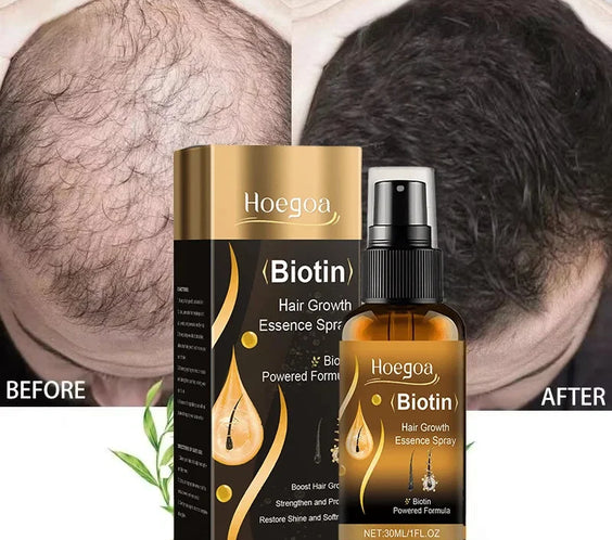 Biotin Hair Growth Spray 30ml bottle eelhoe CPNP certified with ginger root peony root and grape seed oil labels