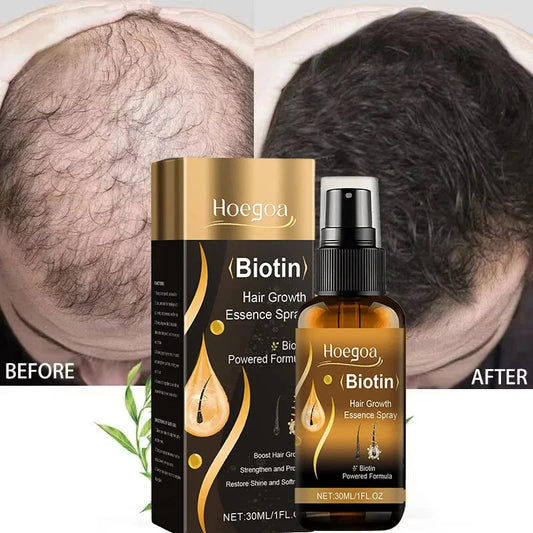 Biotin Hair Growth Spray 30ml bottle eelhoe CPNP certified with ginger root peony root and grape seed oil labels