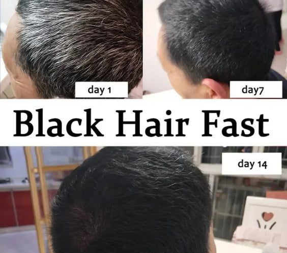 Gray To Black Hair Serum