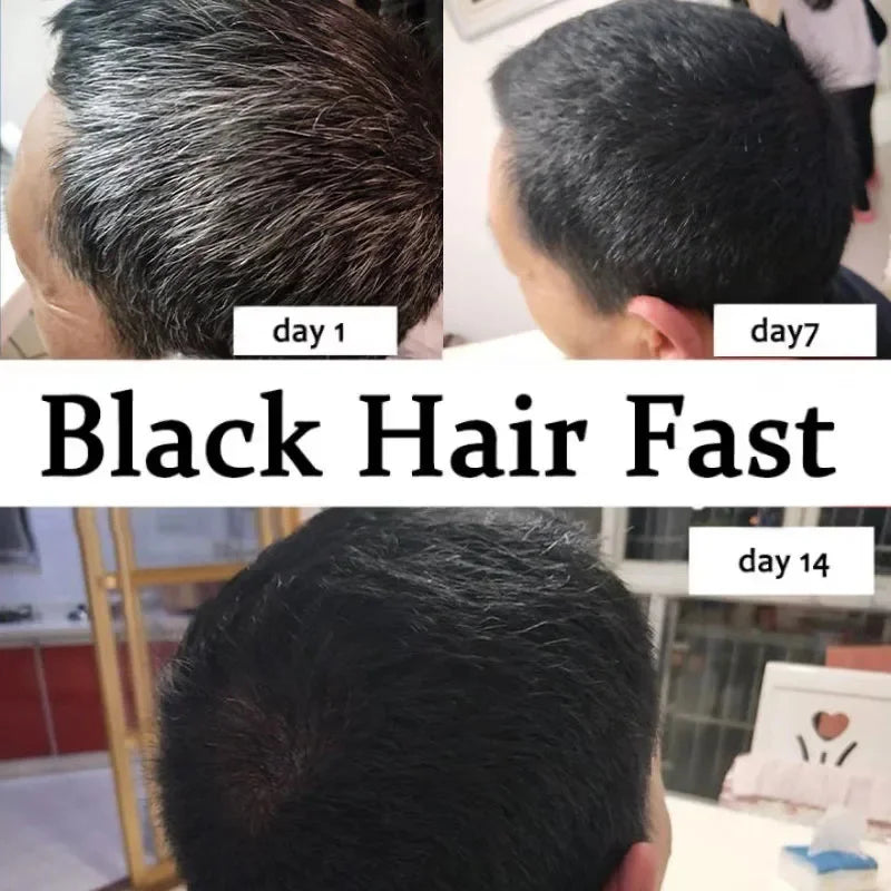Gray To Black Hair Serum