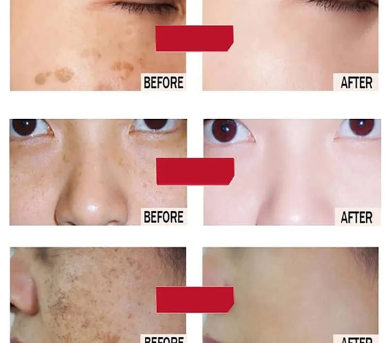 Vitamin C Hyaluronic Mask