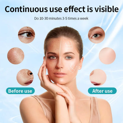 7-Color LED Anti-Aging Mask - Beauty Bae