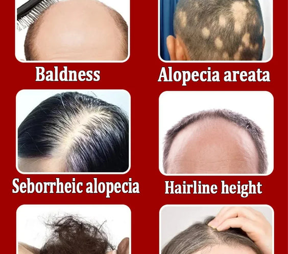 Scalp Serum Kit for Thinning