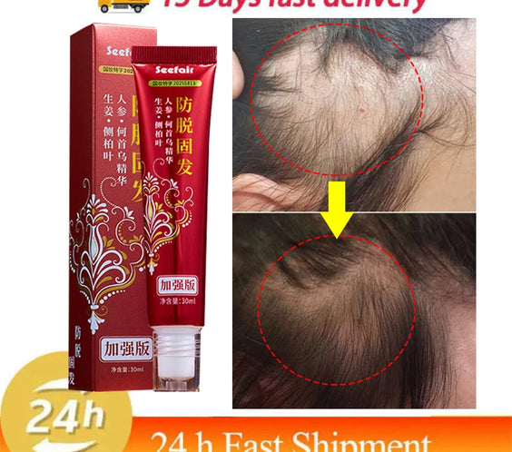 Fast Hair Regrowth Cream