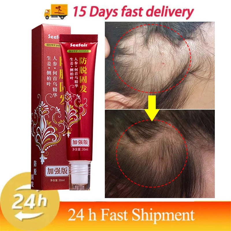 Fast Hair Regrowth Cream