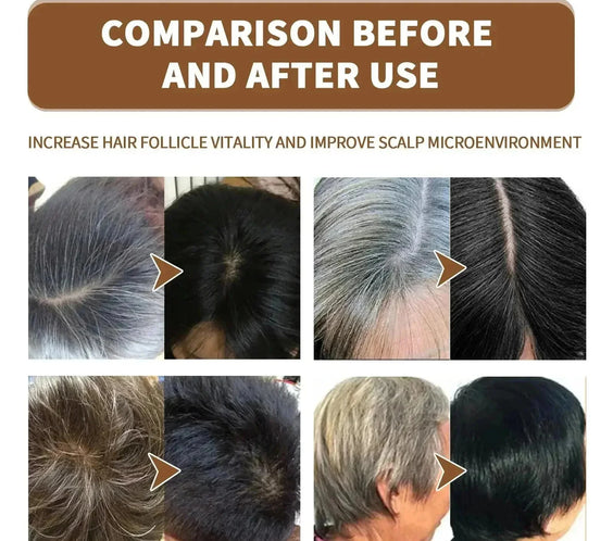 Gray To Black Hair Serum