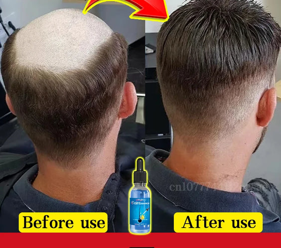 30ml Hair Growth Scalp Oil bottle with dropper labeled anti-hair loss production license 2025040878