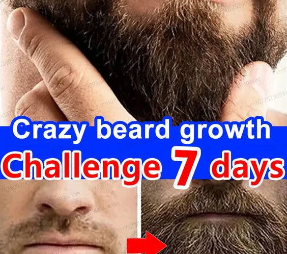 Beard Growth Essence 30ml