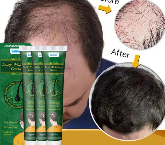 5 Days Hair Growth Cream 20g tube labeled ginger extract plant extract topical scalp treatment Production License 202508299