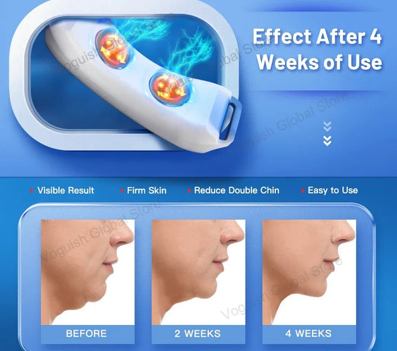 V-Line EMS Chin Lift Belt