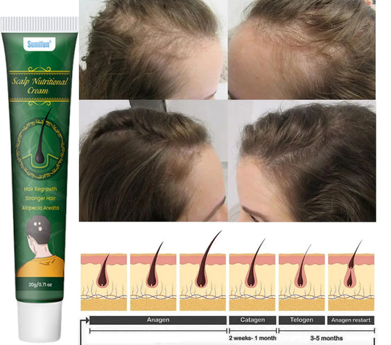 5 Days Ginger Scalp Cream