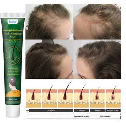 5 Days Ginger Scalp Cream - Beauty Bae