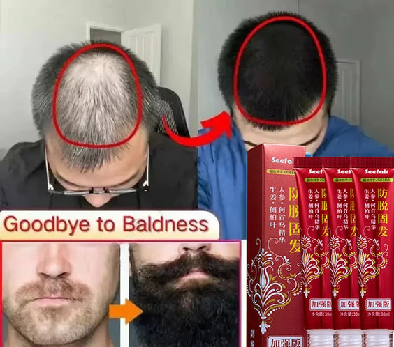 Fast Hair Regrowth Cream