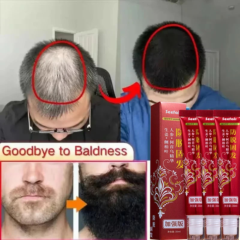 Fast Hair Regrowth Cream