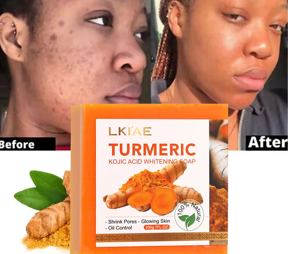 Turmeric Whitening Soap 200g