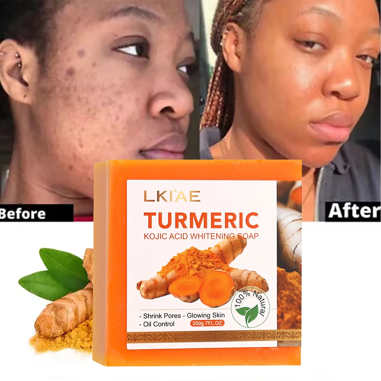 Turmeric Whitening Soap 200g - Beauty Bae
