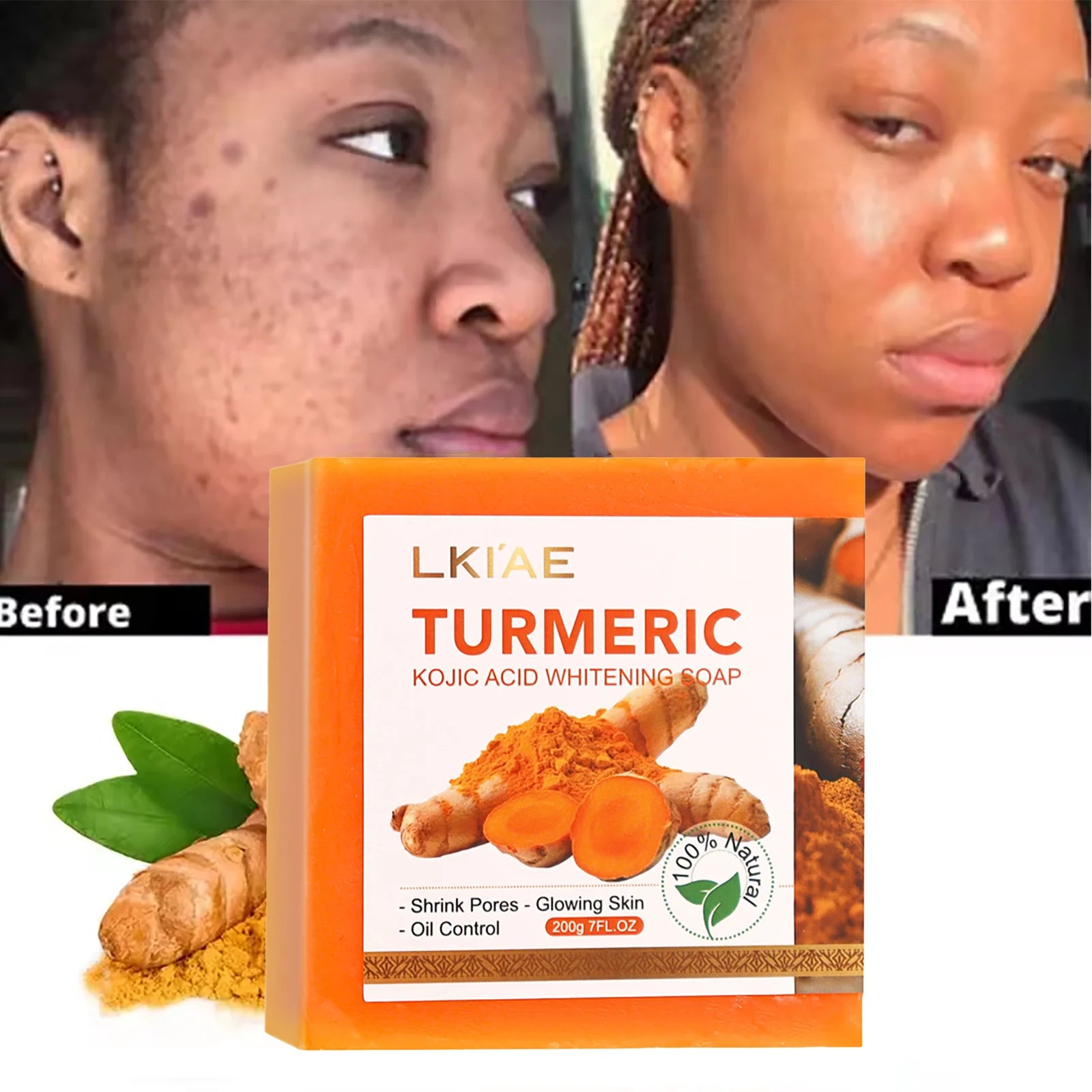 Turmeric Whitening Soap 200g