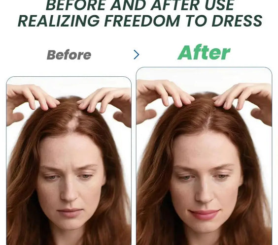 Fast Hair Regrowth Cream