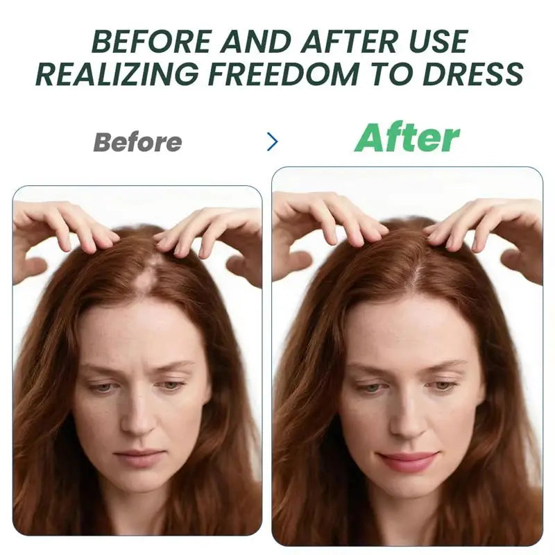 Fast Hair Regrowth Cream