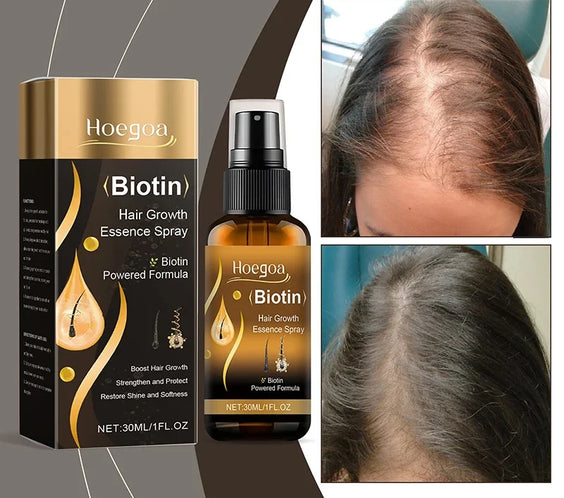 Biotin Hair Growth Spray 30ml