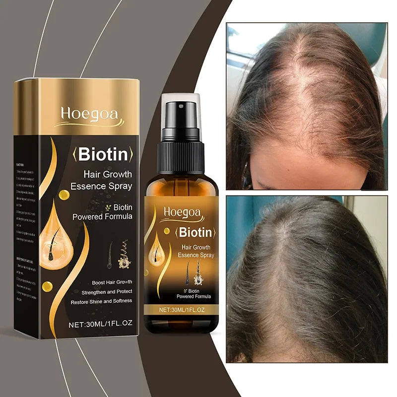 Biotin Hair Growth Spray 30ml