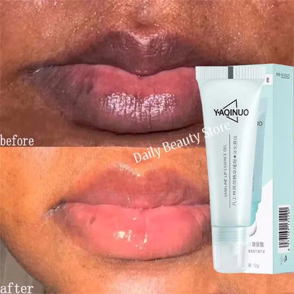 Turmeric Lip Lightening - Beauty Bae